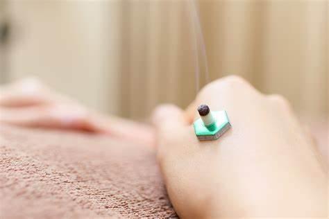 鍼灸×カッピングで水はけがいいカラダになろう！